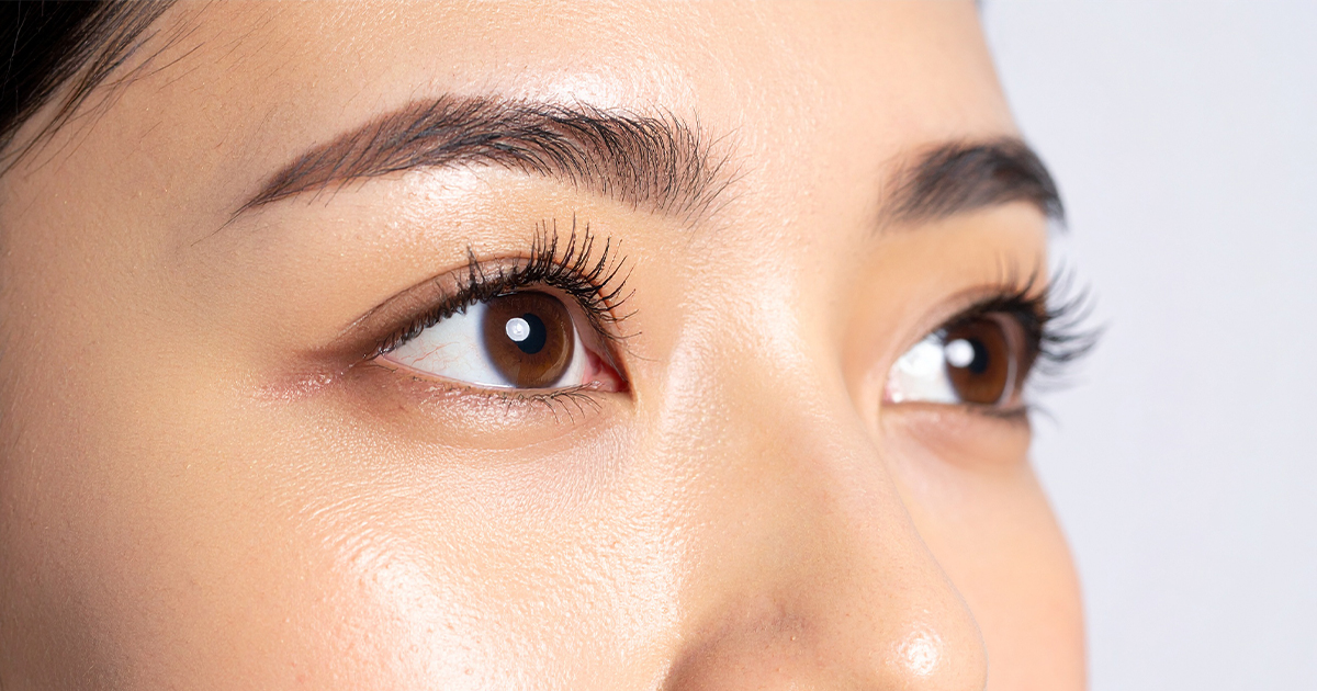 Aクリニックで目の下のたるみ改善を