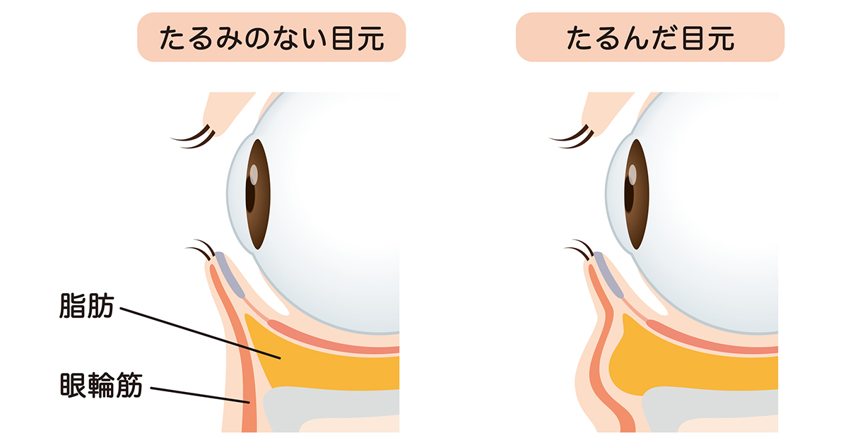目がたるむ仕組み