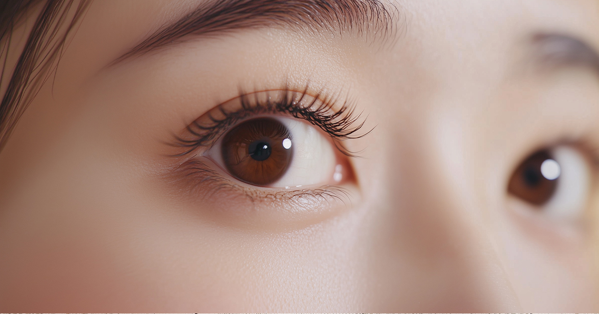 Aクリニックの目の下のたるみ解消治療