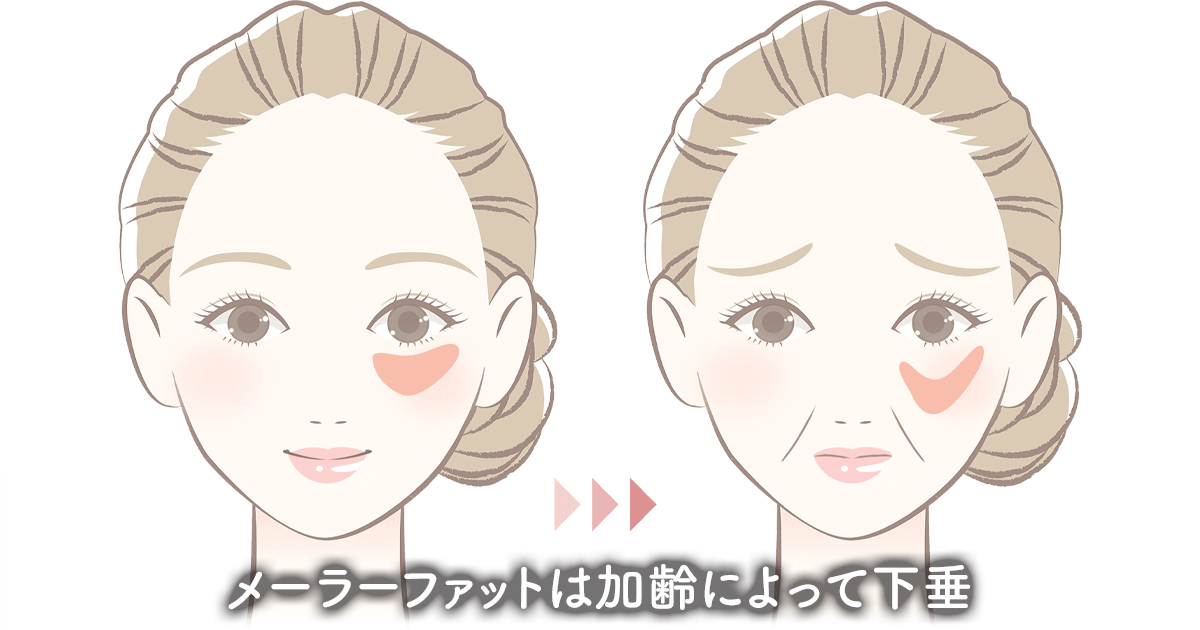 メーラーファットはどこにある？年齢とともに起こる変化