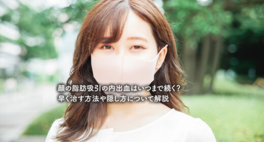 顔の脂肪吸引の内出血はいつまで続く？早く治す方法や隠し方について解説